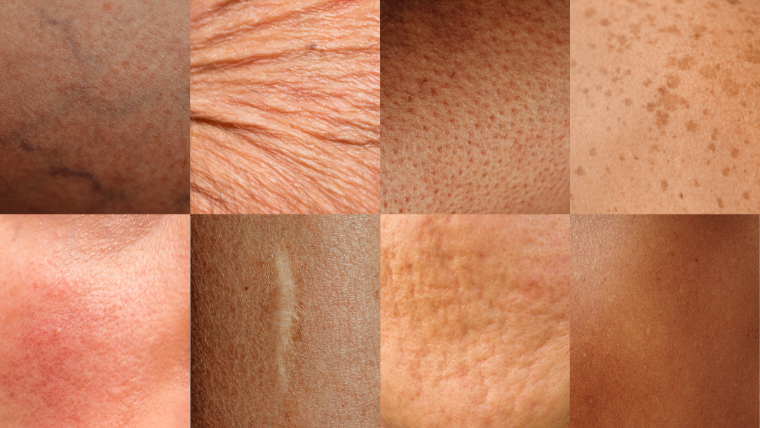 What Are the Most Common Misconceptions About Skin Types?
