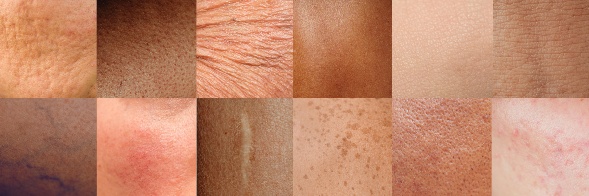 Diverse skin textures and tones showcasing natural skin conditions, ideal for skincare product targeting all skin types and ages.