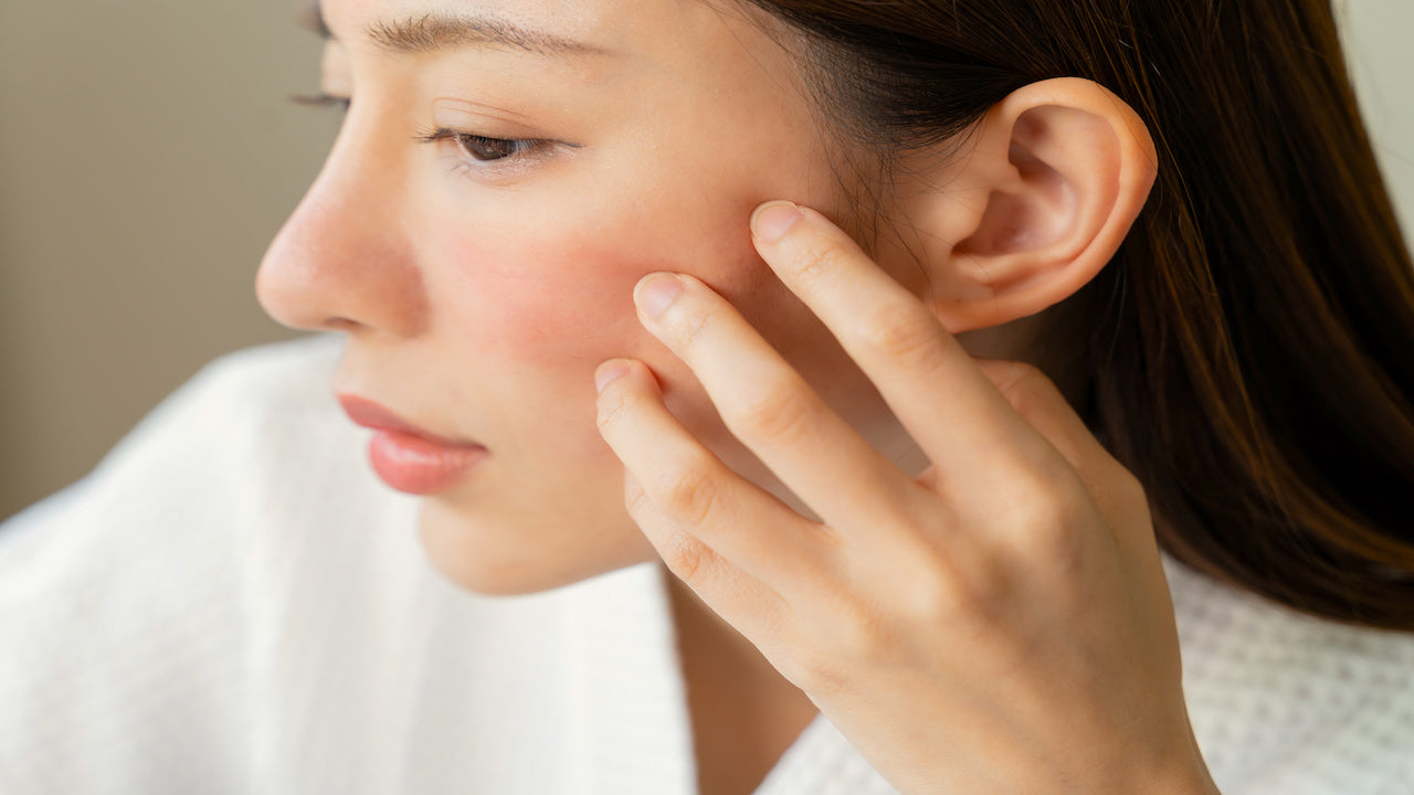 Redness & irritation